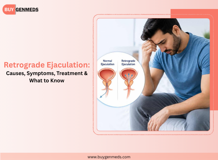Retrograde Ejaculation