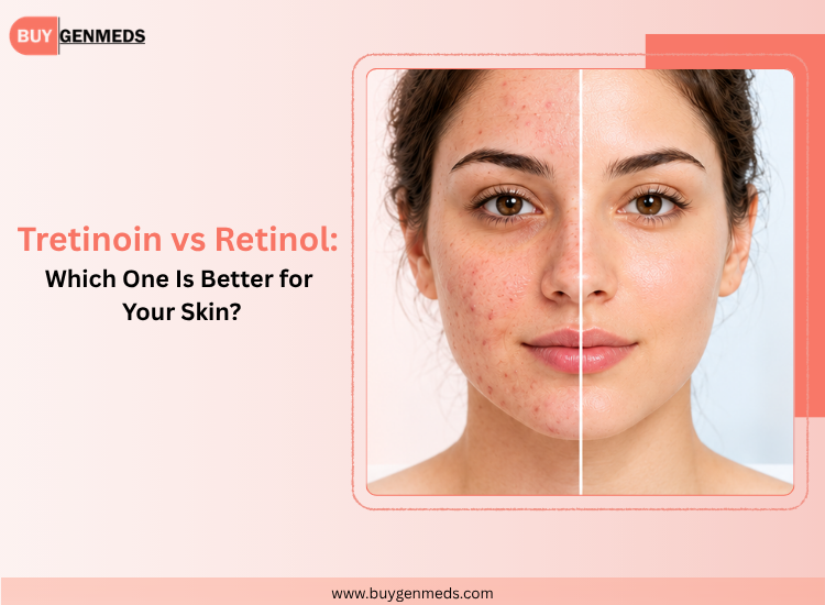 Tretinoin vs Retinol