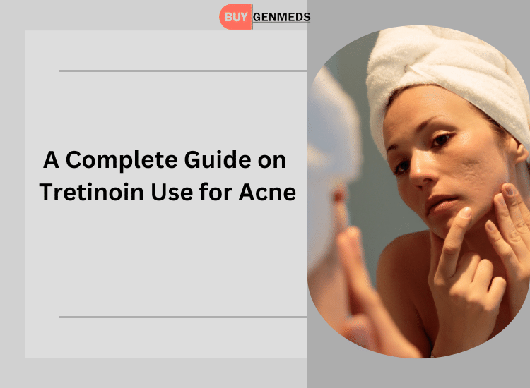 Tretinoin