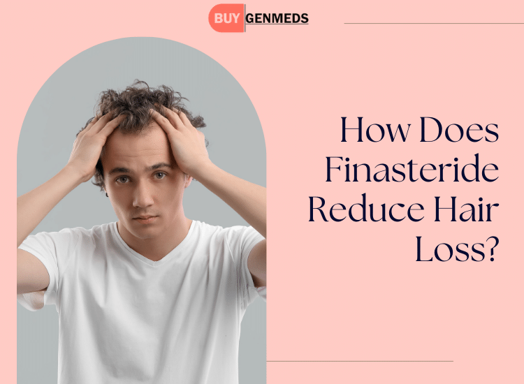 Finasteride