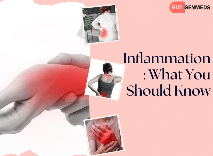 Inflammation