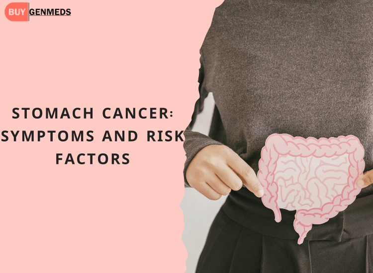 Stomach Cancer