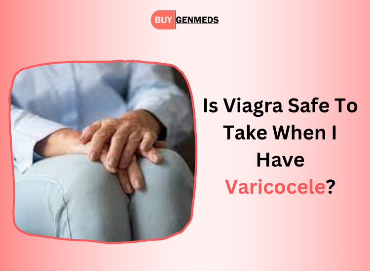 Varicocele