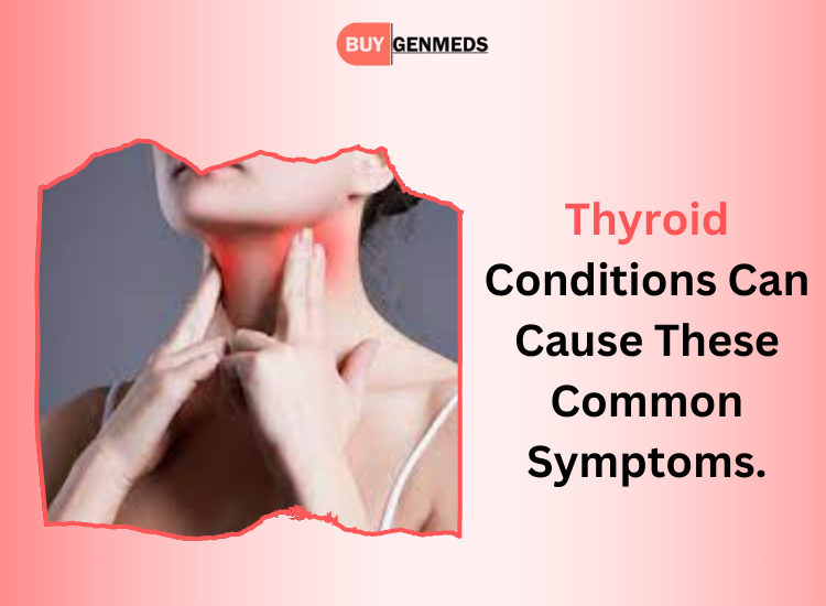 Thyroid